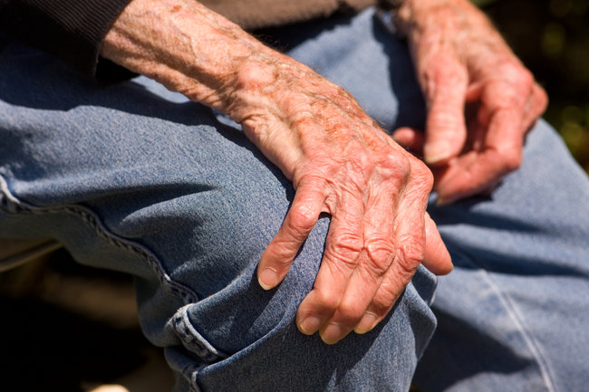 Parkinson: símptomes i com tractar el malalt